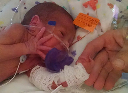 Izabel, in the NICU in 2014.